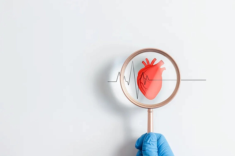 Факторы риска и профилактика фибрилляций предсердий